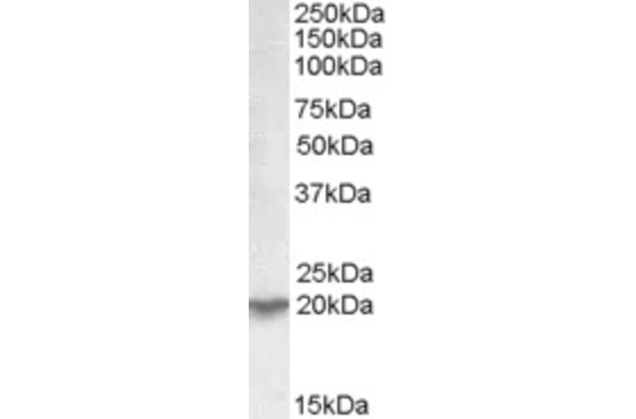Western Blot - Anti-UXT Antibody (A82869) - Antibodies.com