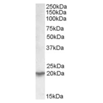 Western Blot - Anti-UXT Antibody (A82869) - Antibodies.com