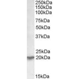 Western Blot - Anti-UXT Antibody (A82869) - Antibodies.com
