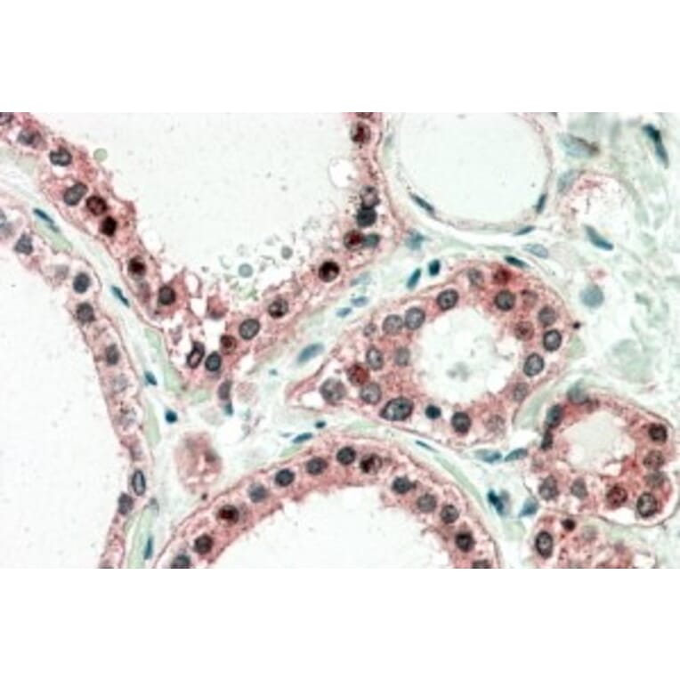 Immunohistochemistry - Anti-UXT Antibody (A82869) - Antibodies.com