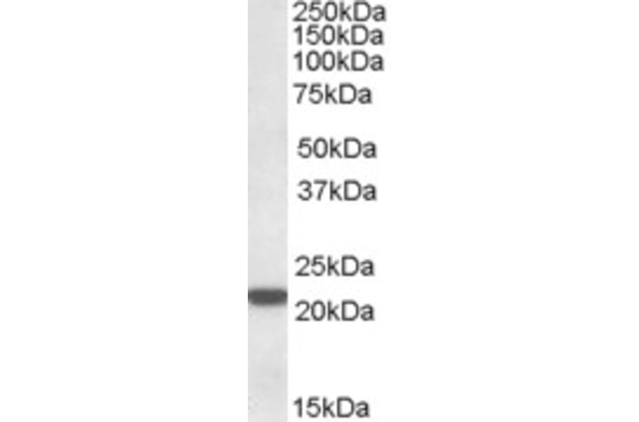 Western Blot - Anti-LMP7 Antibody (A82871) - Antibodies.com