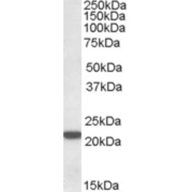 Western Blot - Anti-LMP7 Antibody (A82871) - Antibodies.com