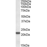 Western Blot - Anti-LMP7 Antibody (A82871) - Antibodies.com