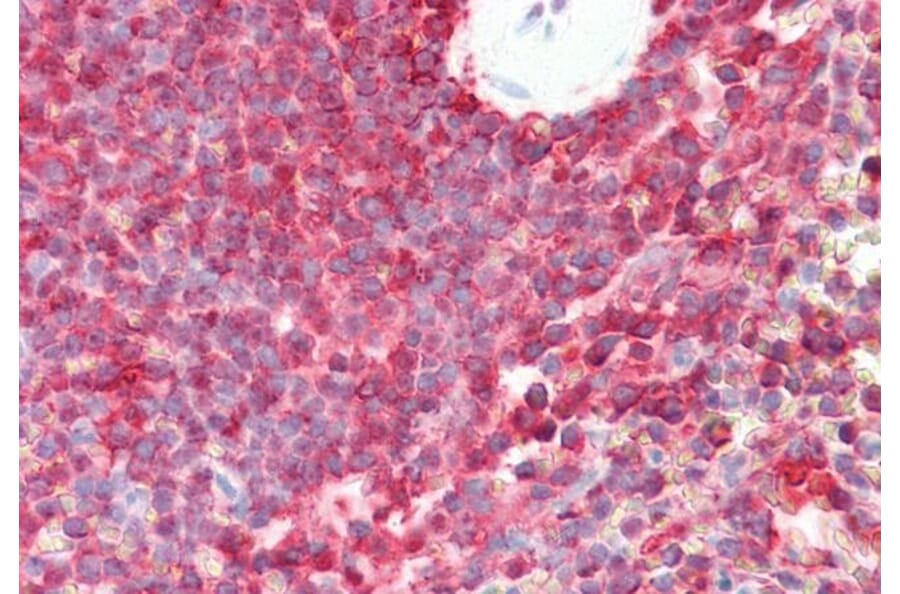 Immunohistochemistry - Anti-LMP7 Antibody (A82871) - Antibodies.com