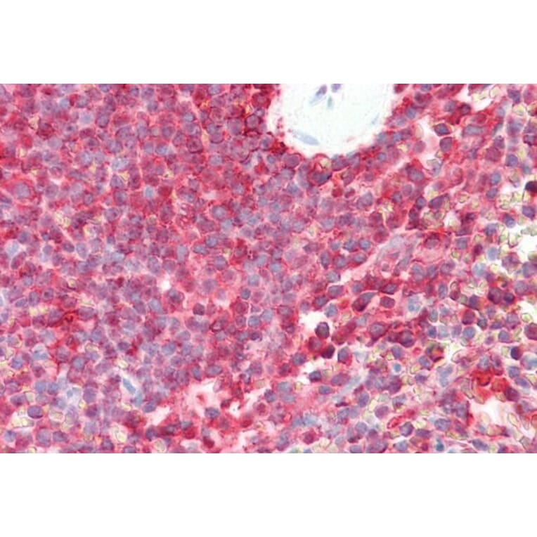 Immunohistochemistry - Anti-LMP7 Antibody (A82871) - Antibodies.com