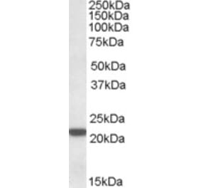 Western Blot - Anti-PSMB8 Antibody (A82871) - Antibodies.com