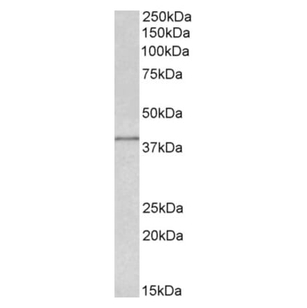 Western Blot - Anti-IDH3G Antibody (A82872) - Antibodies.com