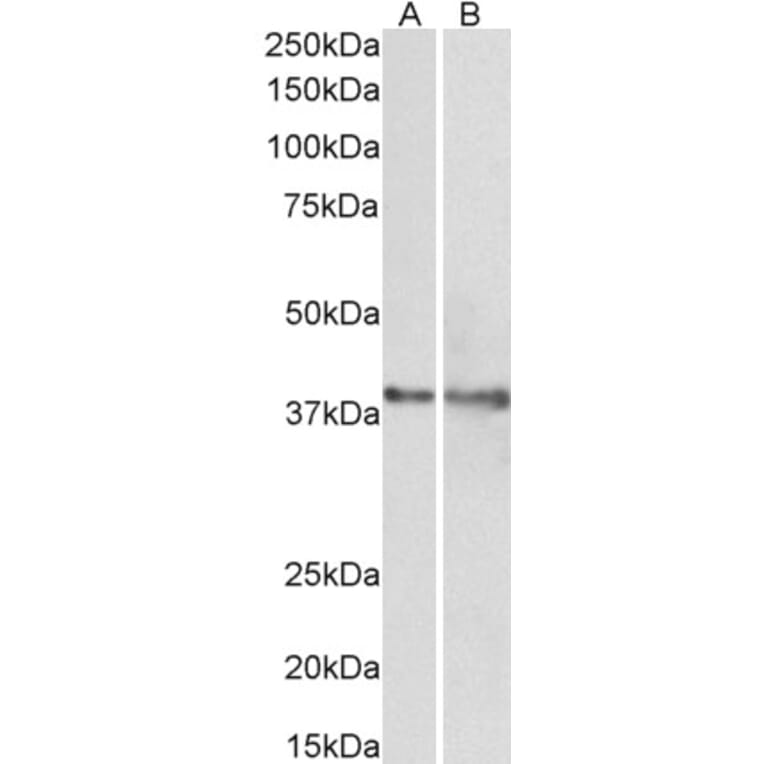 Western Blot - Anti-IDH3G Antibody (A82872) - Antibodies.com