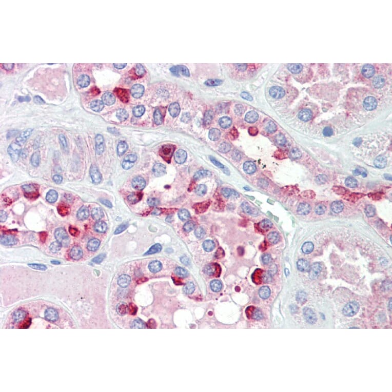 Immunohistochemistry - Anti-IDH3G Antibody (A82872) - Antibodies.com