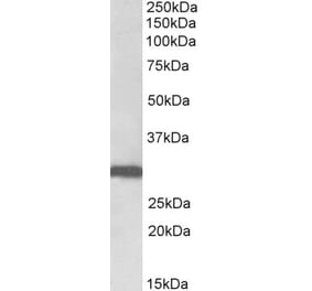 Western Blot - Anti-STOM Antibody (A82873) - Antibodies.com