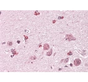 Immunohistochemistry - Anti-CHN2 Antibody (A82874) - Antibodies.com