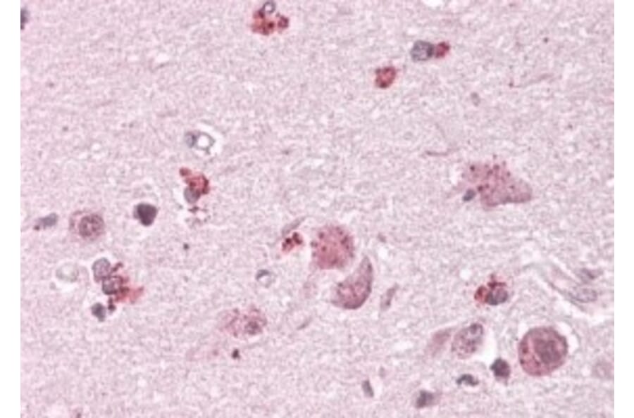 Immunohistochemistry - Anti-CHN2 Antibody (A82874) - Antibodies.com