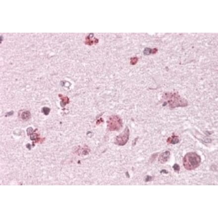 Immunohistochemistry - Anti-CHN2 Antibody (A82874) - Antibodies.com