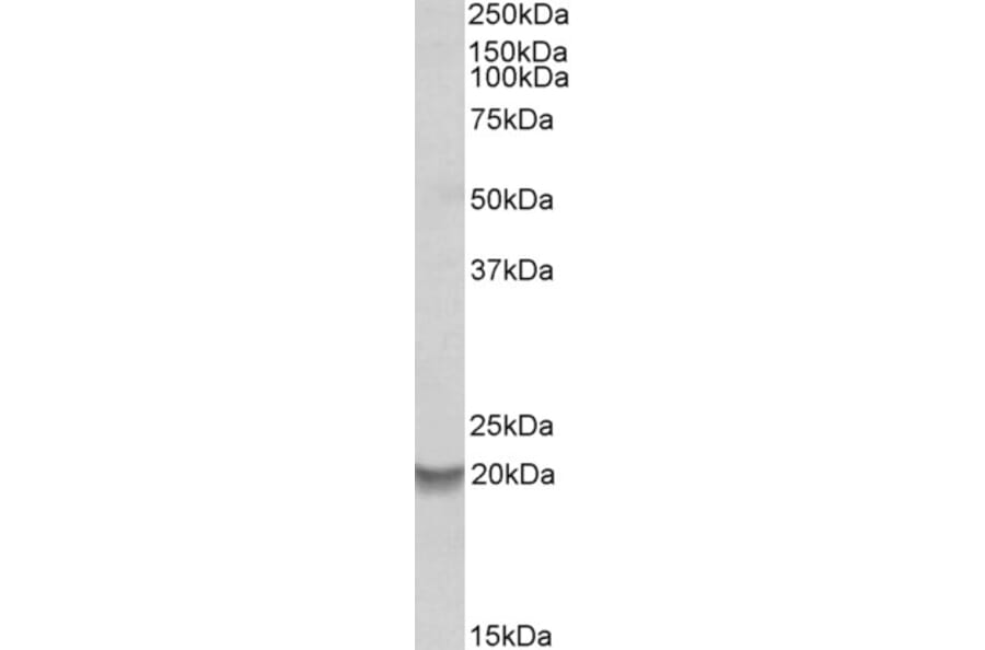 Western Blot - Anti-BFL-1/GRS Antibody (A82875) - Antibodies.com