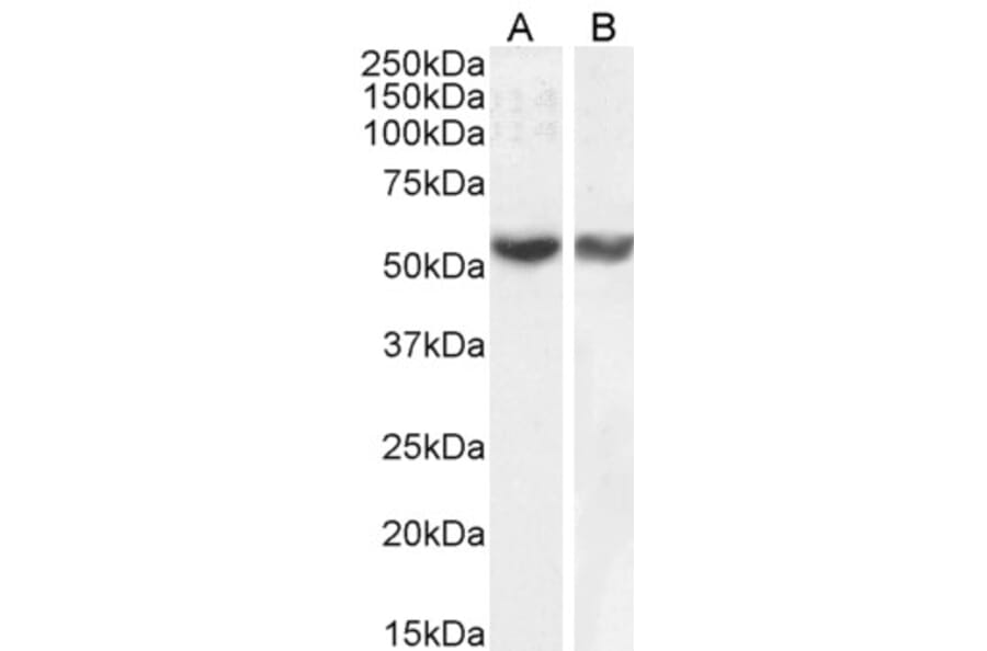 Western Blot - Anti-RNF8 Antibody (A82876) - Antibodies.com