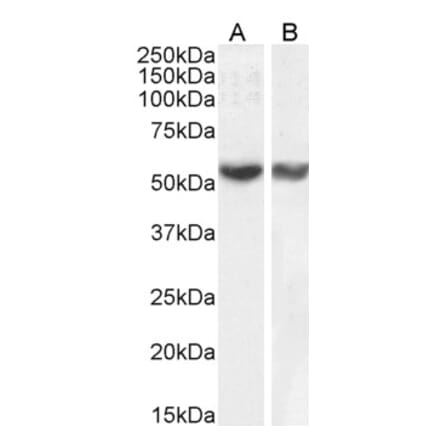 Western Blot - Anti-RNF8 Antibody (A82876) - Antibodies.com