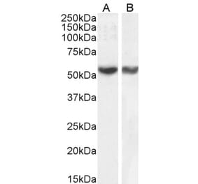 Western Blot - Anti-RNF8 Antibody (A82876)