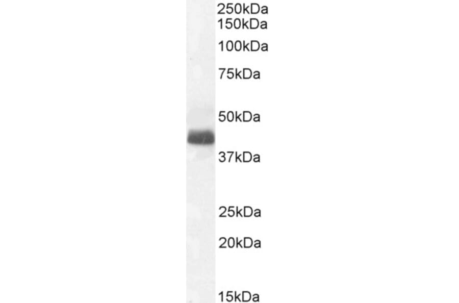 Western Blot - Anti-WISP1 Antibody (A82877) - Antibodies.com