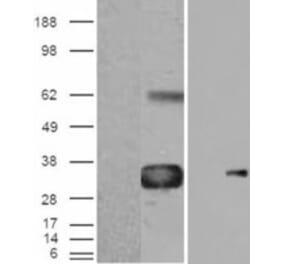 Western Blot - Anti-WISP1 Antibody (A82877) - Antibodies.com