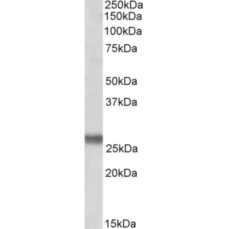 Western Blot - Anti-SNAP23 Antibody (A82878) - Antibodies.com