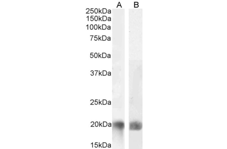 Western Blot - Anti-LIGHT/TNFSF14 Antibody (A82879) - Antibodies.com