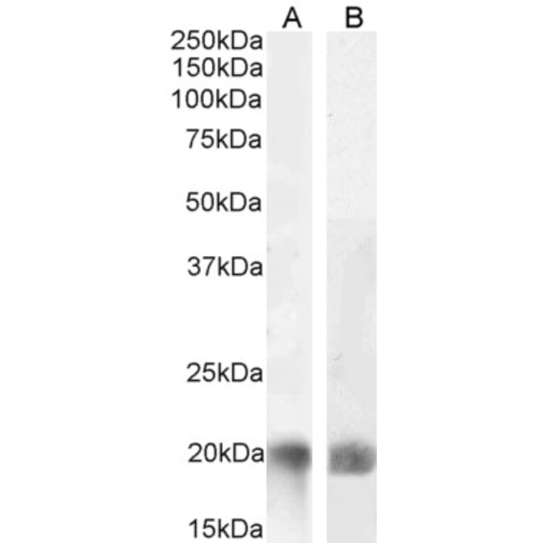 Western Blot - Anti-LIGHT/TNFSF14 Antibody (A82879) - Antibodies.com