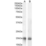 Western Blot - Anti-LIGHT/TNFSF14 Antibody (A82879) - Antibodies.com