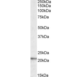 Western Blot - Anti-TNFSF14 Antibody (A82879) - Antibodies.com