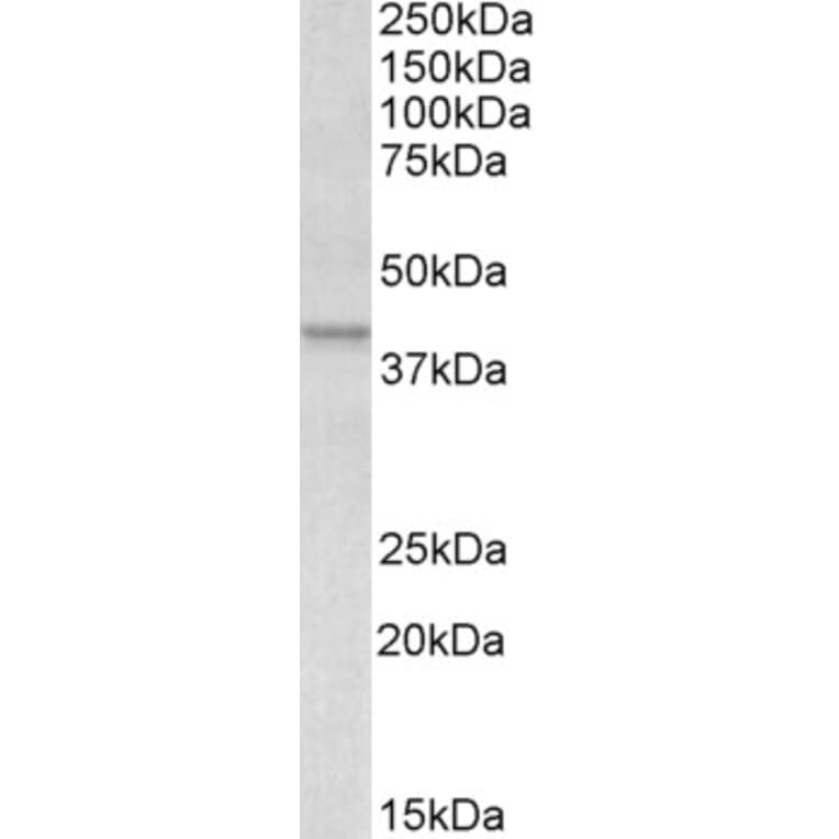 Western Blot - Anti-Apolipoprotein L1/APOL1 Antibody (A82881) - Antibodies.com