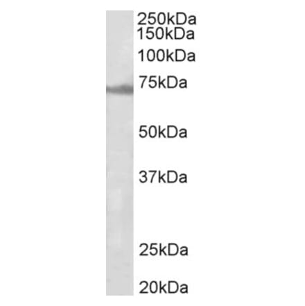Western Blot - Anti-ENC1 Antibody (A82882) - Antibodies.com