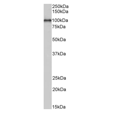 Western Blot - Anti-ADAM12 Antibody (A82884) - Antibodies.com