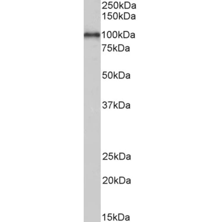 Western Blot - Anti-ADAM12 Antibody (A82884) - Antibodies.com