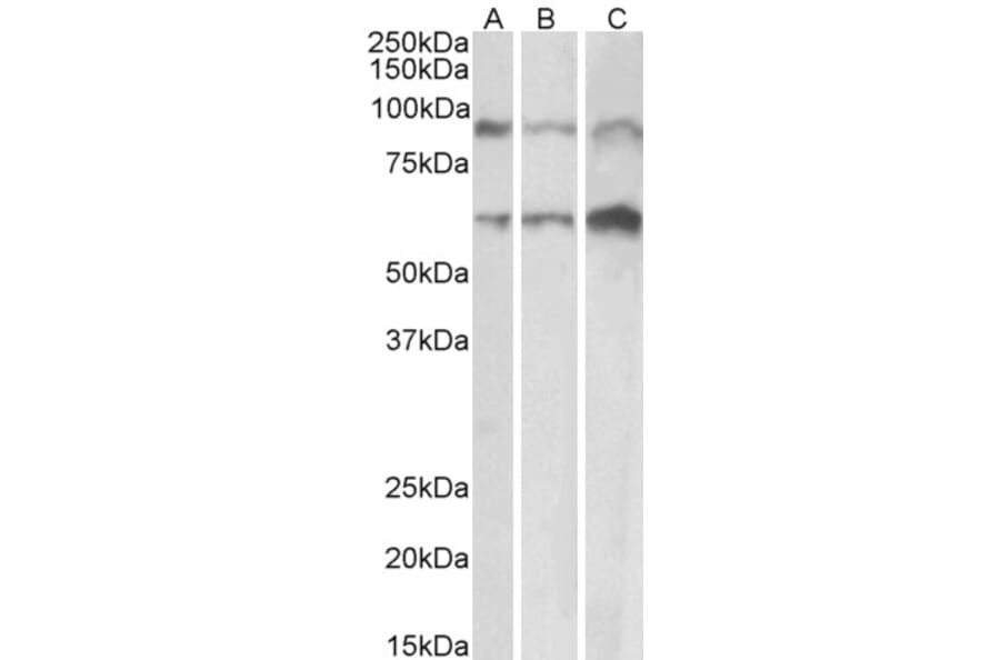 Western Blot - Anti-ADAM12 Antibody (A82884) - Antibodies.com