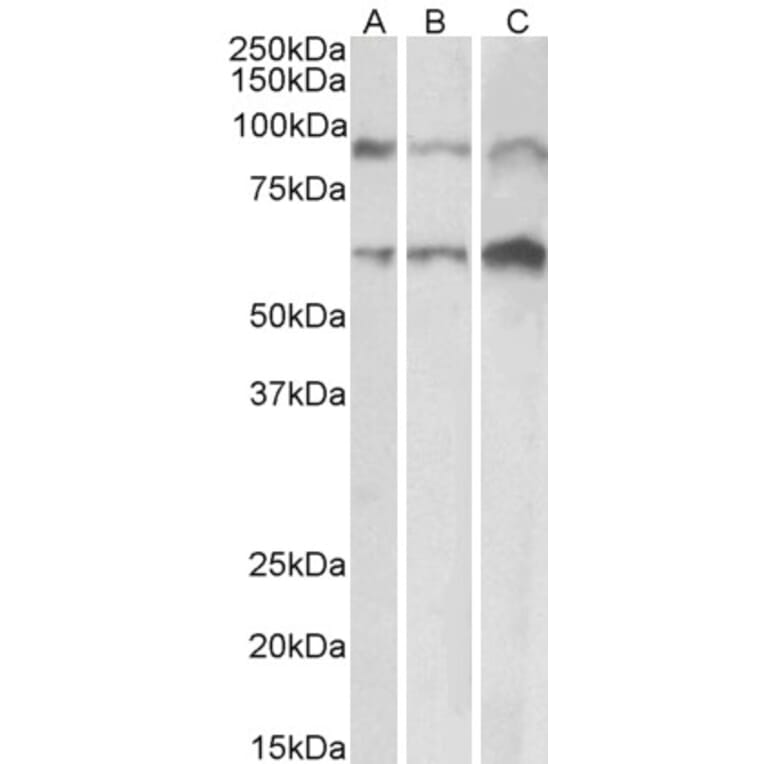 Western Blot - Anti-ADAM12 Antibody (A82884) - Antibodies.com