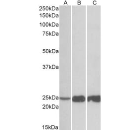 Western Blot - Anti-Troponin I Fast Skeletal Muscle Antibody (A82885) - Antibodies.com