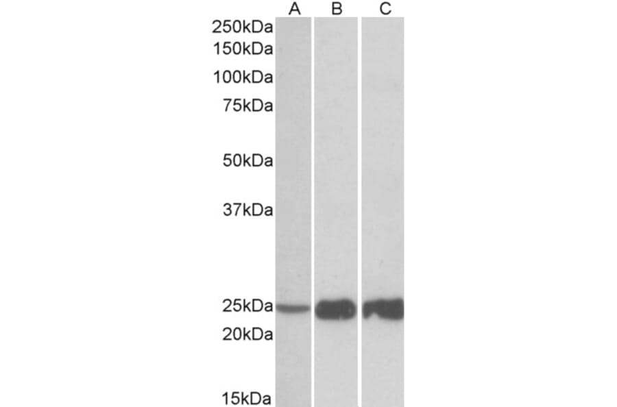 Western Blot - Anti-Troponin I Fast Skeletal Muscle Antibody (A82885) - Antibodies.com