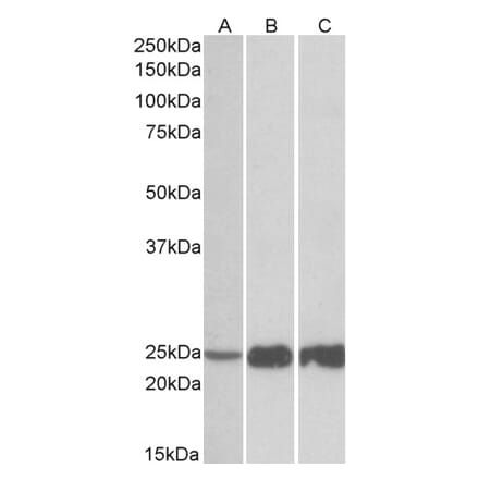 Western Blot - Anti-Troponin I Fast Skeletal Muscle Antibody (A82885) - Antibodies.com