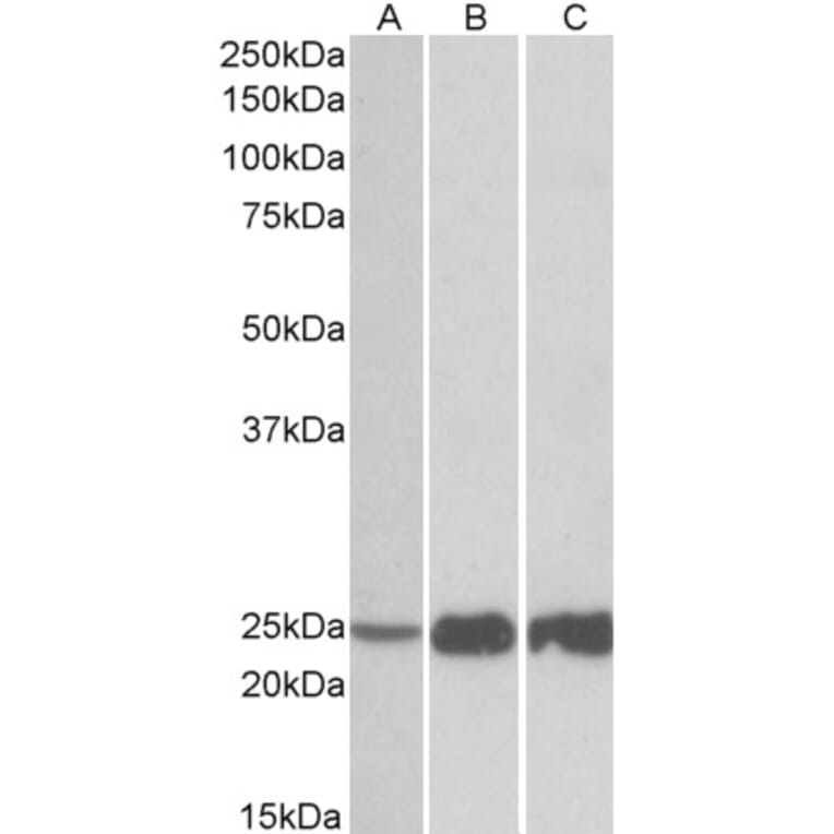 Western Blot - Anti-Troponin I Fast Skeletal Muscle Antibody (A82885) - Antibodies.com