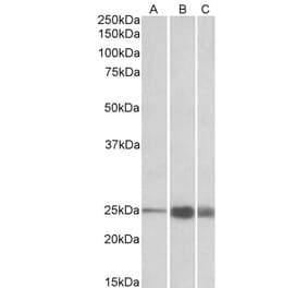 Western Blot - Anti-Troponin I Fast Skeletal Muscle Antibody (A82886) - Antibodies.com