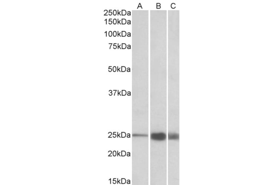 Western Blot - Anti-Troponin I Fast Skeletal Muscle Antibody (A82886) - Antibodies.com