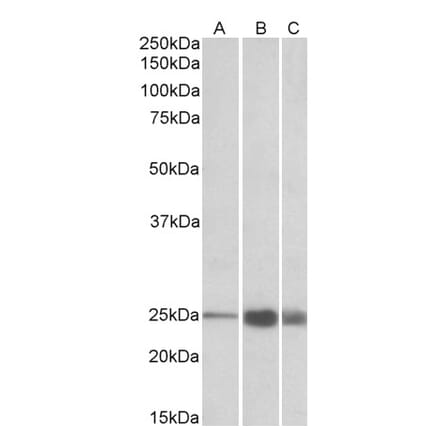 Western Blot - Anti-Troponin I Fast Skeletal Muscle Antibody (A82886) - Antibodies.com