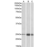 Western Blot - Anti-Troponin I Fast Skeletal Muscle Antibody (A82886) - Antibodies.com