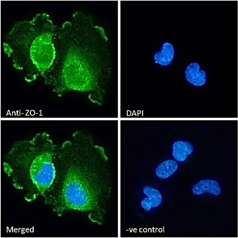 Immunofluorescence - Anti-ZO1 Tight Junction Protein Antibody (A82887) - Antibodies.com