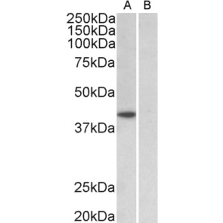 Western Blot - Anti-TATA Binding Protein Antibody (A82888) - Antibodies.com