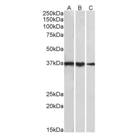 Western Blot - Anti-TBP Antibody (A82888) - Antibodies.com