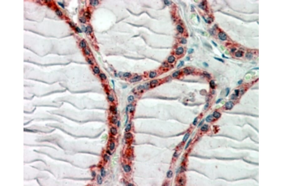 Immunohistochemistry - Anti-CLIP170 Antibody (A82890) - Antibodies.com