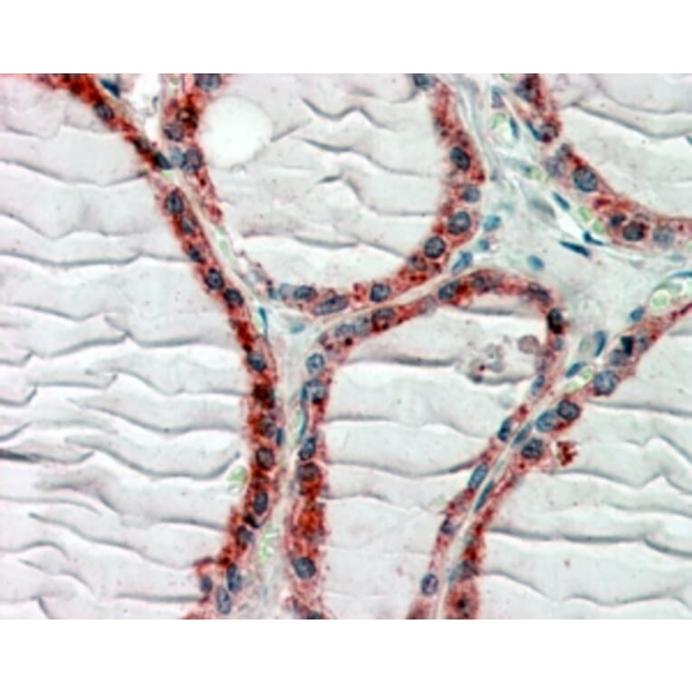 Immunohistochemistry - Anti-CLIP170 Antibody (A82890) - Antibodies.com