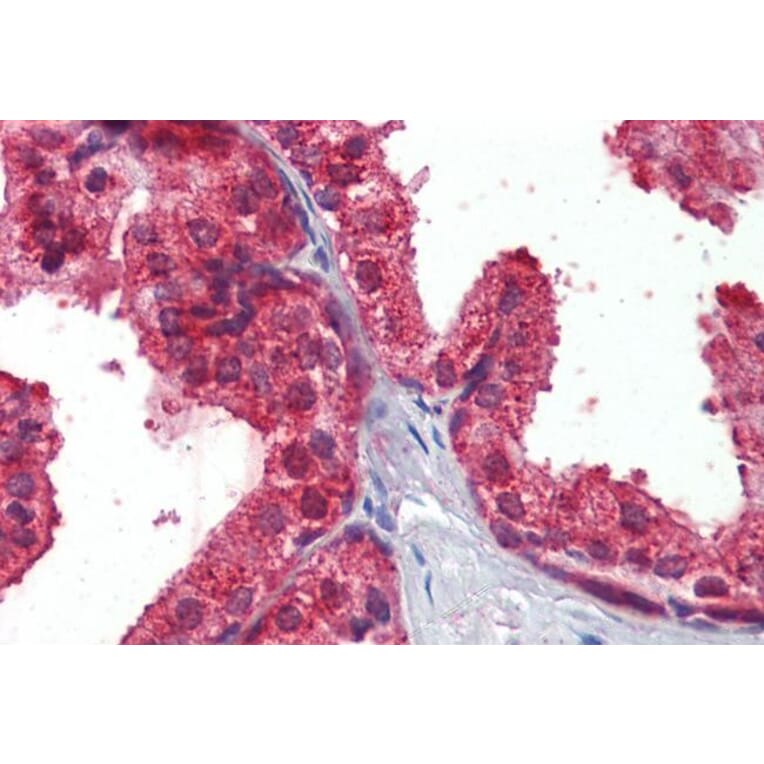 Immunohistochemistry - Anti-CLIP170 Antibody (A82890) - Antibodies.com