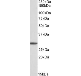 Western Blot - Anti-PSMA4 Antibody (A82893) - Antibodies.com