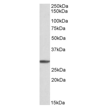 Western Blot - Anti-PSMA4 Antibody (A82893) - Antibodies.com